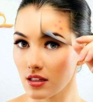 Маски для проблемной кожи лица