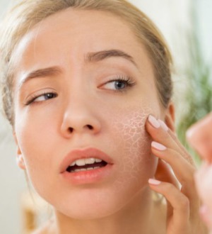 4 отличные маски для сухой кожи лица в домашних условиях